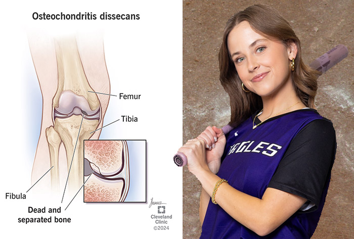 Ozarks' Price living a remarkable comeback story